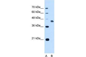 Western Blotting (WB) image for anti-Deafness, Autosomal Dominant 5 (DFNA5) antibody (ABIN2462940) (DFNA5 antibody)