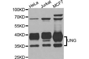 Western blot analysis of extracts of various cell lines, using UNG antibody.