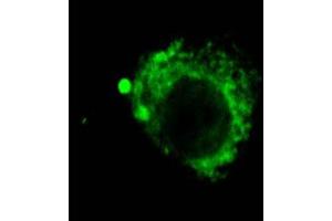 LAMP2 (GL2A7), IF showing distribution of lysosomes in CEC  Courtesy of Eunduck E P Kay, Doheny Eye Institue. (LAMP2 antibody)