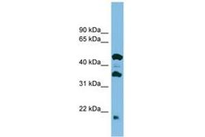 Image no. 1 for anti-Chromosome 11 Open Reading Frame 73 (C11orf73) (C-Term) antibody (ABIN6745127) (C11orf73 antibody  (C-Term))