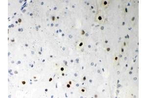 Anti- SF2 Picoband antibody,  IHC(P)IHC(P): Rat Brain Tissue (SRSF1 antibody  (N-Term))