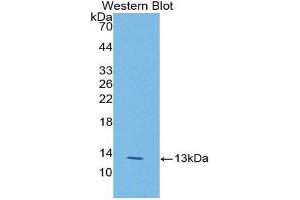 Western Blotting (WB) image for anti-Lysyl Oxidase-Like 2 (LOXL2) (AA 53-160) antibody (ABIN1176463) (LOXL2 antibody  (AA 53-160))