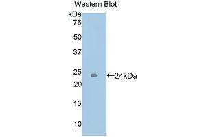 Western blot analysis of the recombinant protein. (ICAM4 antibody  (AA 52-234))