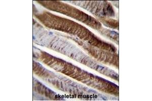 ETFA Antibody (C-term) (ABIN655079 and ABIN2844711) immunohistochemistry analysis in formalin fixed and paraffin embedded human skeletal muscle followed by peroxidase conjugation of the secondary antibody and DAB staining. (ETFA antibody  (C-Term))