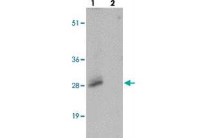 Western blot analysis of SHISA3 in human small intestine tissue with SHISA3 polyclonal antibody  at 1 ug/mL in (lane 1) the absence and (lane 2) the presence of blocking peptide. (SHISA3 antibody  (Internal Region))