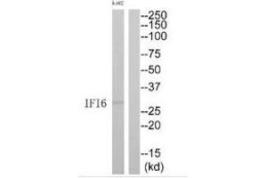 IFI6 抗体  (C-Term)