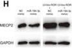 linc-ROR promoted cell proliferation, migration, and invasion of breast cancer through linc-ROR/miR-194-3p/MECP2 regulatory axis. (MECP2 antibody  (AA 1-100))