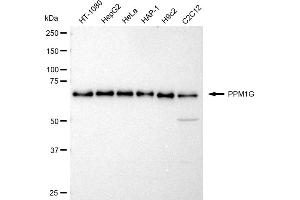 Western blotting analysis using PPM1G antibody (ABIN7800035). (Recombinant PPM1G antibody)