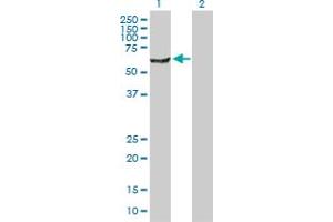 Western Blot analysis of NARS expression in transfected 293T cell line by NARS MaxPab polyclonal antibody. (NARS antibody  (AA 1-548))