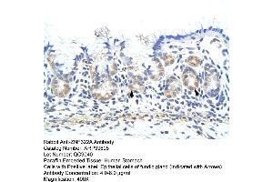 Human Stomach (ZNF322A antibody  (C-Term))