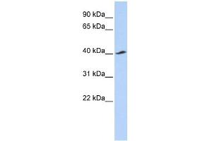 KCNJ16 antibody used at 1 ug/ml to detect target protein.
