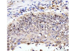 IHC analysis of AKAP 95/AKAP8 using anti-AKAP 95/AKAP8 antibody (ABIN7601553). (AKAP8 antibody  (AA 380-546))