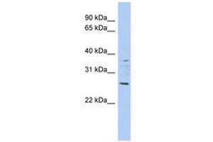 Image no. 1 for anti-Achaete-Scute Complex Homolog 2 (ASCL2) (AA 71-120) antibody (ABIN6742246) (ASCL2 antibody  (AA 71-120))