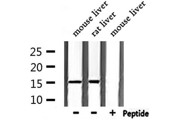 TAC1 antibody  (N-Term)