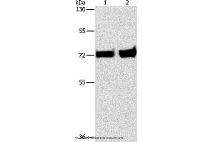 Western blot analysis of Mouse liver and kidney tissue, using PCK1 Polyclonal Antibody at dilution of 1:375 (PCK1 antibody)