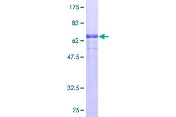 GRP94 Protein (AA 1-315) (GST tag)