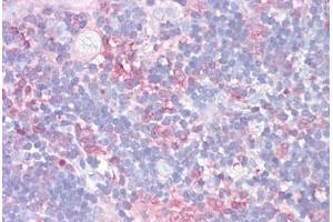 Anti-LGALS9 / Galectin-9 antibody IHC staining of human thymus. (Galectin 9 antibody  (AA 51-100))