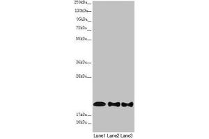 Western blot All lanes: NDUFB10 antibody at 2. (NDUFB1 antibody  (AA 1-172))