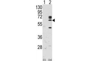 Western Blotting (WB) image for anti-RYK Receptor-Like Tyrosine Kinase (RYK) antibody (ABIN5023605)