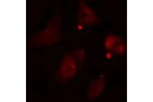 ABIN6274582 staining HepG2 cells by IF/ICC.
