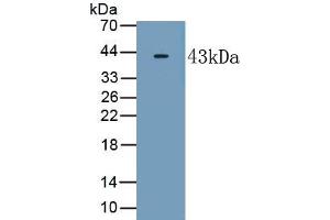 Detection of Recombinant RAMP2, Human using Polyclonal Antibody to Receptor Activity Modifying Protein 2 (RAMP2) (RAMP2 antibody  (AA 43-145))