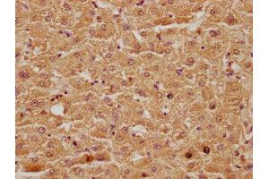 IHC image of ABIN7146081 diluted at 1:100 and staining in paraffin-embedded human liver tissue performed on a Leica BondTM system. (CLEC4G antibody  (AA 66-293))