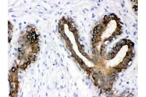 Immunohistochemistry (Paraffin-embedded Sections) (IHC (p)) image for anti-Keratin 19 (KRT19) (AA 334-372), (C-Term) antibody (ABIN3043288) (Cytokeratin 19 antibody  (C-Term))