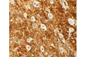 Immunohistochemistry (IHC) image for anti-rho-Associated, Coiled-Coil Containing Protein Kinase 2 (ROCK2) (Middle Region) antibody (ABIN1031072) (ROCK2 antibody  (Middle Region))