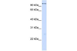 WB Suggested Anti-DHX15 Antibody Titration:  0. (DHX15 antibody  (C-Term))