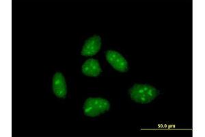 Immunofluorescence of purified MaxPab antibody to CRI1 on HeLa cell.