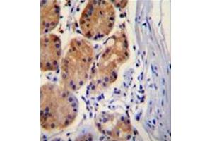 Formalin fixed, paraffin embedded human stomach tissuem stained with Catenin beta-1 Antibody (C-term) followed by peroxidase conjugation of the secondary antibody and DAB staining. (CTNNB1 antibody  (C-Term))