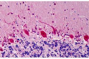 Human Brain: Formalin-Fixed, Paraffin-Embedded (FFPE) (COPS5 antibody)