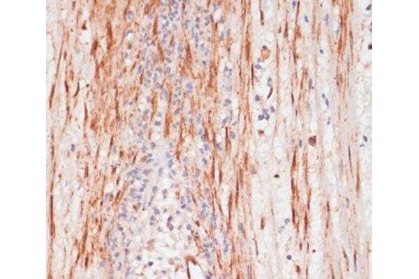 PEA15 antibody  (pSer104)