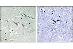 Immunohistochemistry (IHC) image for anti-V-Raf-1 Murine Leukemia Viral Oncogene Homolog 1 (RAF1) (AA 251-300) antibody (ABIN2889118) (RAF1 antibody  (AA 251-300))