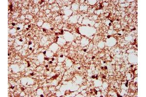 IHC image of ABIN7170618 diluted at 1:200 and staining in paraffin-embedded human brain tissue performed on a Leica BondTM system. (SF3B1 antibody  (AA 186-378))