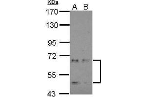 WB Image Sample (30 ug of whole cell lysate) A: NT2D1 B: IMR32 7. (CDKL3 antibody)