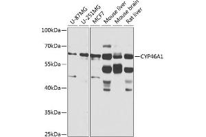 Western blot analysis of extracts of various cell lines, using CYP46 antibody (ABIN6130168, ABIN6139358, ABIN6139359 and ABIN6224675) at 1:1000 dilution.