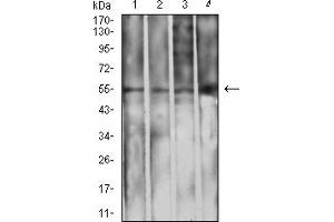 Western blot analysis using IghA1 mouse mAb against L1210 (1), THP-1 (2), HepG2 (3), and COS7 (4) cell lysate. (IGHA1 antibody  (AA 207-353))