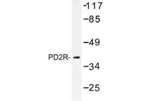 Image no. 1 for anti-Prostaglandin D2 Receptor (PTGDR) antibody (ABIN317875) (PTGDR antibody)
