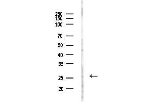 Western blot analysis of lysates from HUVEC cells(LPC4h treatment), using CHCH Antibody at 1/1000 dilution.