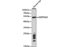 Western blot analysis of extracts of mouse eye, using SERPINB3 antibody (ABIN1876606) at 1:1000 dilution. (SERPINB3 antibody)