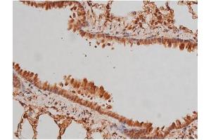 Immunohistochemistry (IHC) image for anti-Microtubule-Associated Protein tau (MAPT) (pSer262) antibody (ABIN6256228)