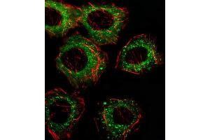 Immunofluorescence (IF) image for anti-Fatty Acid Desaturase 2 (FADS2) antibody (ABIN2928602)