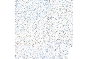 Immunohistochemistry (IHC) image for anti-Zinc Finger E-Box Binding Homeobox 1 (ZEB1) (AA 750-800) antibody (ABIN7455173)