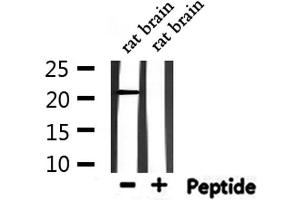 Western blot analysis of extracts from rat brain, using RAP1A Antibody. (RAP1A antibody  (C-Term))