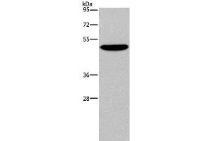 Western Blot analysis of SKOV3 cell using NECTIN4 Polyclonal Antibody at dilution of 1:350 (PVRL4 antibody)
