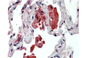 IHC staining of FFPE human lung with IDE antibody at 2. (IDE antibody)
