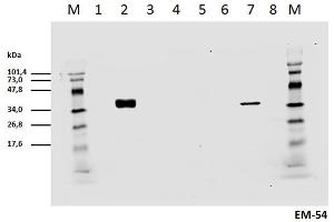 Cell lyzates of HEK293T/17 cells transiently transfected with expression vectors harboring genes for mCD3zeta wild type and six different mCD3zeta mutants, where particular ITAM tyrosines were substituted with phenylalanines, were prepared. (CD247 antibody  (pTyr142))