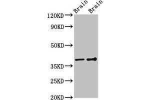 Western Blot Positive WB detected in: Rat brain tissue, Mouse brain tissue All lanes: GNB1 antibody at 3 μg/mL Secondary Goat polyclonal to rabbit IgG at 1/50000 dilution Predicted band size: 38, 37 kDa Observed band size: 38 kDa (GNB1 antibody  (AA 157-248))