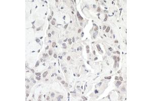 Immunohistochemistry (IHC) image for anti-Zinc Finger E-Box Binding Homeobox 1 (ZEB1) (AA 1074-1124) antibody (ABIN7448887)